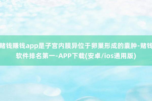 赌钱赚钱app是子宫内膜异位于卵巢形成的囊肿-赌钱软件排名第一-APP下载(安卓/ios通用版)